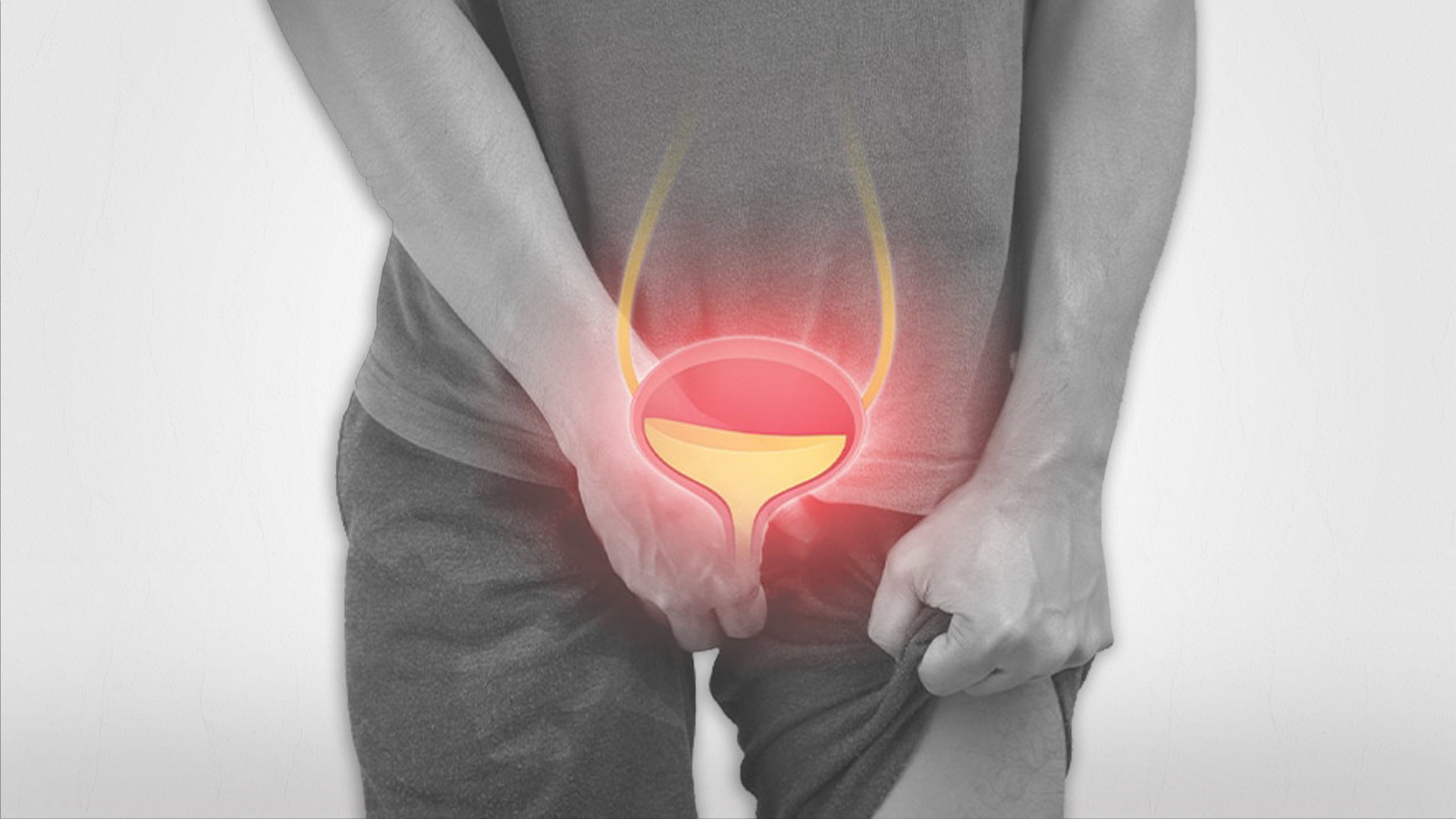 Prostatitis: Causes, Symptoms, and Treatment