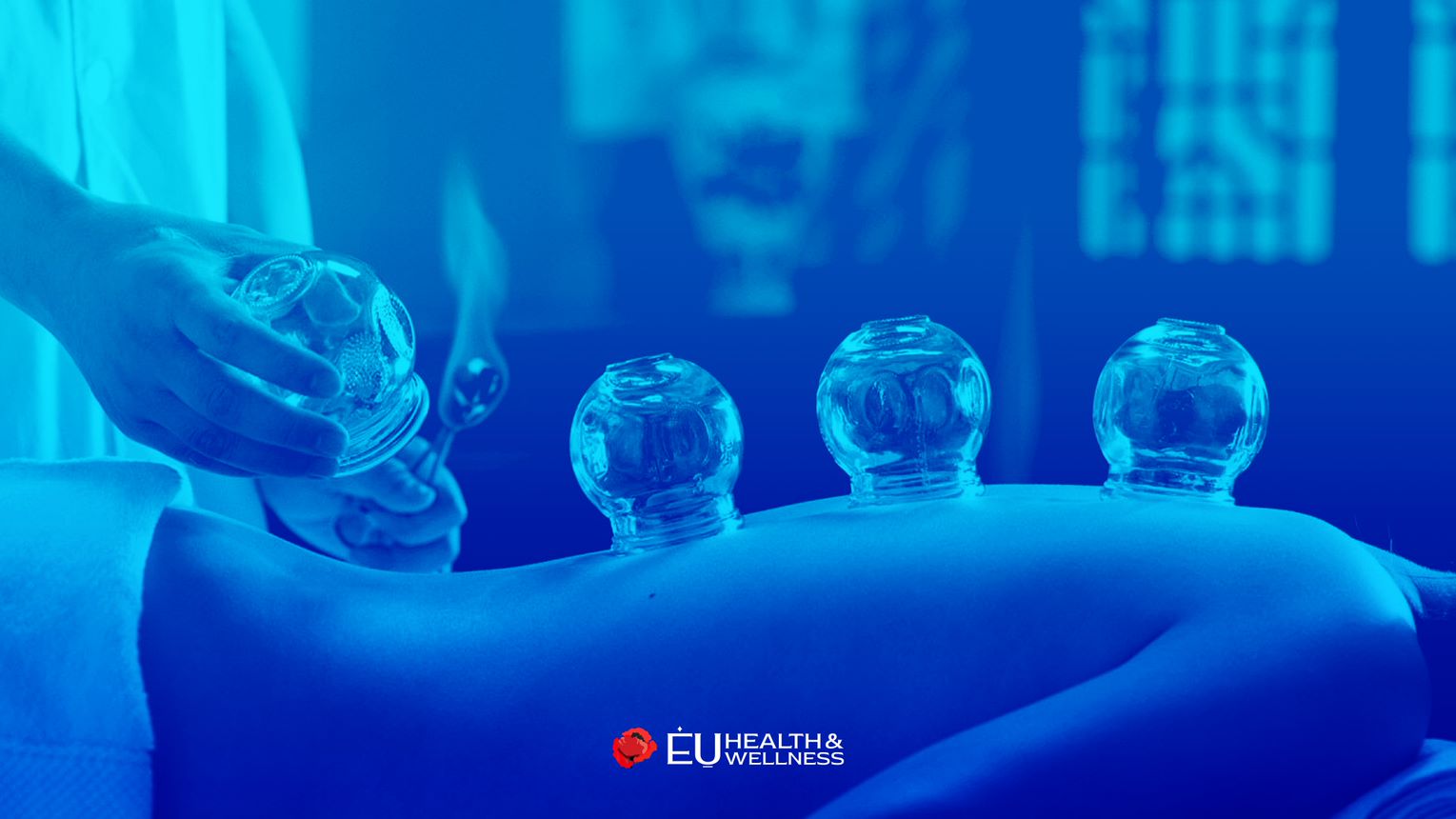 Cupping Therapy EU Health Wellness