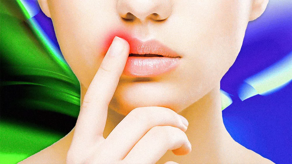 Genital Herpes Treatment: Buy Valtrex (Valacyclovir) in Bangkok, Thailand